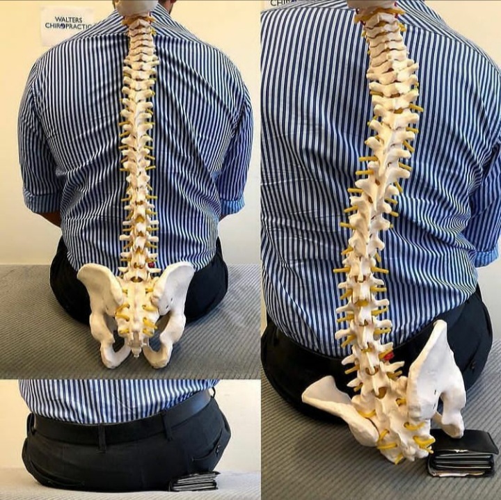 spinal dysfunction